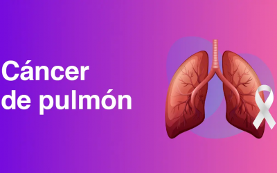 Síntomas del cáncer de pulmón